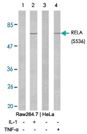 Anti-RELA Rabbit Polyclonal Antibody