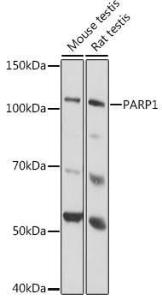 Western blot analysis of extracts of various cell lines, using Anti-PARP1 Antibody [ARC0075] (A306436) at 1:1000 dilution. The secondary Antibody was Goat Anti-Rabbit IgG H&L Antibody (HRP) at 1:10000 dilution. Lysates/proteins were present at 25 µg per lane