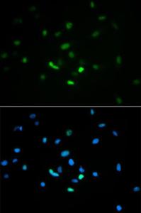 Immunofluorescence analysis of MCF-7 cells using Anti-p53 Antibody (A11620)