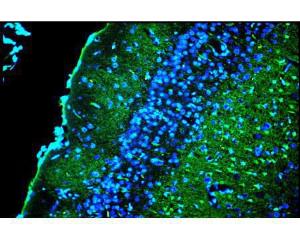 Double exposure using combined blue and µltraviolet epi-fluorescent illumination of the superficial layers of the cingulated rat cortex exposed to kainic acid. Photo is courtesy of Dr. Larry Schmued.