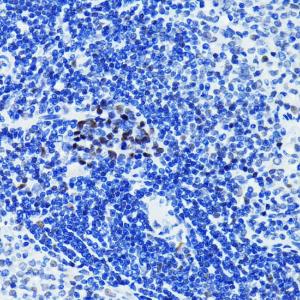 Immunohistochemistry analysis of paraffin-embedded rat spleen using Anti-PARP1 Antibody [ARC0075] (A306436) at a dilution of 1:100 (40X lens). Perform microwave antigen retrieval with 10 mM PBS buffer pH 7.2 before commencing with IHC staining protocol