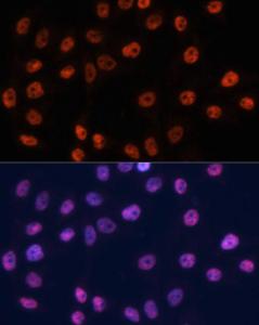 Immunofluorescence analysis of HeLa cells using Anti-p53 Antibody (A11620) at a dilution of 1:100. DAPI was used to stain the cell nuclei (blue)