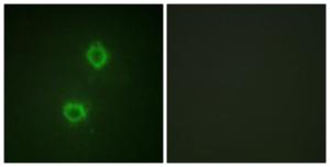 Immunofluorescence analysis of HUVEC cells using Anti-FGFR1 Antibody. The right hand panel represents a negative control, where the antibody was pre-incubated with the immunising peptide