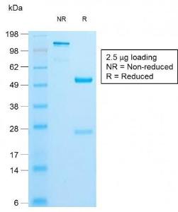 Antibody anti-CALPONIN 1 RCNN1832 100 µg