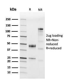 Anti-CD45 antibody