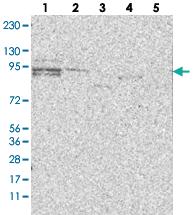 Anti-GALNTL6 Rabbit Polyclonal Antibody