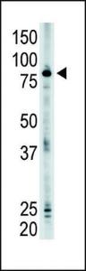 Anti-SMURF2 Rabbit Polyclonal Antibody (FITC (Fluorescein))