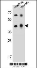 Anti-ADAL Rabbit Polyclonal Antibody (Biotin)