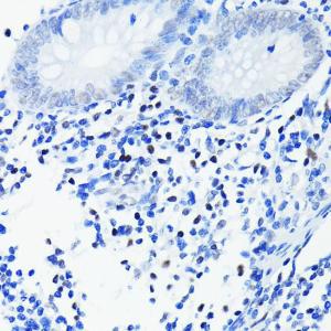 Immunohistochemistry analysis of paraffin-embedded human appendix tissue using Anti-PARP1 Antibody [ARC0075] (A306436) at a dilution of 1:100 (40X lens). Perform microwave antigen retrieval with 10 mM PBS buffer pH 7.2 before commencing with IHC staining protocol