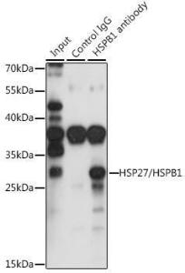 Immunoprecipitation analysis of 200 µg extracts of HepG2 cells using 3 µg of Anti-Hsp27 Antibody (A307909). This Western blot was performed on the immunoprecipitate using Anti-Hsp27 Antibody (A307909) at a dilution of 1:1000