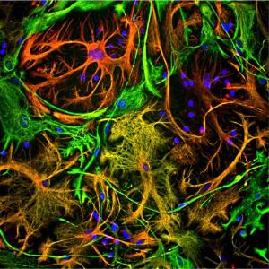 Immunofluorescent analysis of cortical neuron-glial cell culture from E20 rat stained with Anti-Vimentin Antibody (1:5,000 / green) and Anti-GFAP Antibody (A85419 / 1:5,000 / red). The blue is DAPI staining of nuclear DNA. Fibroblastic cells contain only vimentin, so they are green.