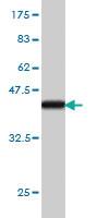 Anti-ITGB3BP Mouse Monoclonal Antibody [clone: 3F6]