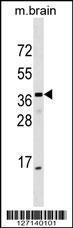 Anti-ELMOD1 Rabbit Polyclonal Antibody