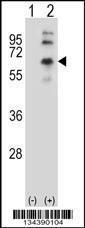 Anti-CHRM2 Rabbit Polyclonal Antibody (AP (Alkaline Phosphatase))