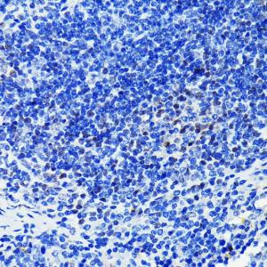 Immunohistochemistry analysis of paraffin-embedded mouse spleen using Anti-PARP1 Antibody [ARC0075] (A306436) at a dilution of 1:100 (40X lens). Perform microwave antigen retrieval with 10 mM PBS buffer pH 7.2 before commencing with IHC staining protocol