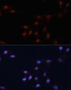 Immunofluorescence analysis of NIH/3T3 cells using Anti-p53 Antibody (A11620) at a dilution of 1:100. DAPI was used to stain the cell nuclei (blue)