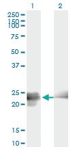 Anti-BIN3 Mouse Monoclonal Antibody [clone: 3G3]