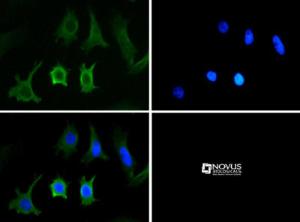 Anti-Niemann-Pick C1 Rabbit Polyclonal Antibody