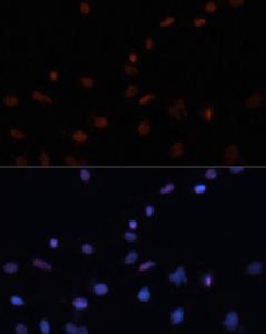 Immunofluorescence analysis of C6 cells using Anti-p53 Antibody (A11620) at a dilution of 1:100. DAPI was used to stain the cell nuclei (blue)