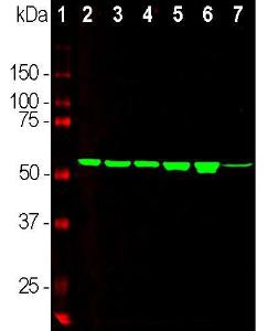 Western blot analysis of cell and whole brain tissue lysates using Anti-Vimentin Antibody (1:5,000 / green): [1] protein standard (red), [2] HEK293, [3] HeLa, [4] COS-1, [5] C6 cells, and [6] rat brain. The band at about 50 kDa mark corresponds to vimentin.