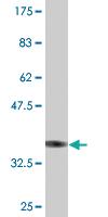 Anti-PHF7 Mouse Monoclonal Antibody [clone: 1A7]