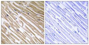 Immunohistochemical analysis of paraffin-embedded human heart tissue using Anti-NDRG4 Antibody. The right hand panel represents a negative control, where the antibody was pre-incubated with the immunising peptide.