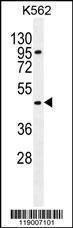 Anti-CPA3 Rabbit Polyclonal Antibody (HRP (Horseradish Peroxidase))