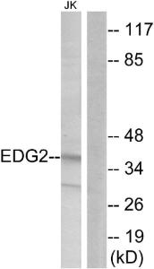 Western blot analysis of lysates from Jurkat cells using Anti-EDG2 Antibody. The right hand lane represents a negative control, where the antibody is blocked by the immunising peptide