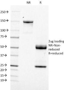 SDS-PAGE analysis of Anti-TOP1MT Antibody [TOP1MT/488] under non-reduced and reduced conditions; showing intact IgG and intact heavy and light chains, respectively. SDS-PAGE analysis confirms the integrity and purity of the antibody.