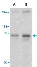 Anti-NUP107 Rabbit Polyclonal Antibody