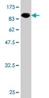 Anti-SPDL1 Mouse Monoclonal Antibody [clone: 2F4]