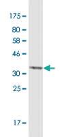 Anti-RET Mouse Monoclonal Antibody [clone: 3A6]