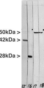 Western blot of crude extract of the human carcinoma HeLa cell line. Lane 18 was probed with Anti-Vimentin Antibody - showing a single sharp band at the expected molecular weight of 50 kDa. Lane 18 was probed with Anti-Vimentin Antibody (A85424).