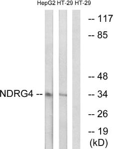 Western blot analysis of lysates from HT-29 and HepG2 cells using Anti-NDRG4 Antibody. The right hand lane represents a negative control, where the antibody is blocked by the immunising peptide.