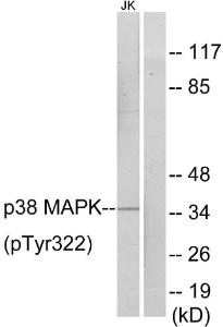 Anti-p38 MAPK