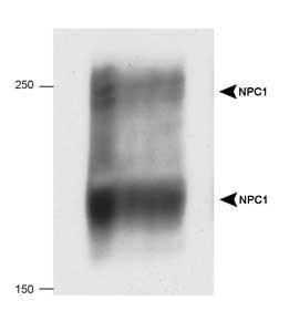 Anti-Niemann-Pick C1 Rabbit Polyclonal Antibody