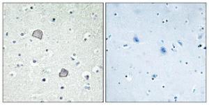 Immunohistochemical analysis of paraffin-embedded human brain tissue using Anti-EDG2 Antibody. The right hand panel represents a negative control, where the antibody was pre-incubated with the immunising peptide