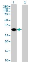 Anti-CENPH Mouse Polyclonal Antibody