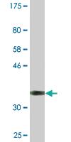 Anti-DUX3 Mouse Monoclonal Antibody [clone: 3D2]