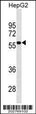 Anti-CD33 Mouse Monoclonal Antibody [clone: 574CT16.4.4]