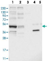 Anti-KCNJ8 Rabbit Polyclonal Antibody