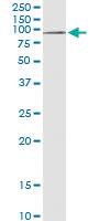 Anti-AGBL5 Rabbit Polyclonal Antibody