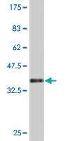 Anti-PHF7 Mouse Monoclonal Antibody [clone: 3F3]