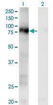 Anti-CD93 Mouse Monoclonal Antibody [clone: 1A4]