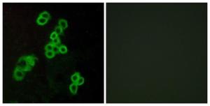 Immunofluorescence analysis of MCF7 cells using Anti-EDG2 Antibody. The right hand panel represents a negative control, where the antibody was pre-incubated with the immunising peptide