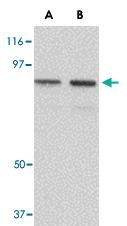 Anti-NUP107 Rabbit Polyclonal Antibody