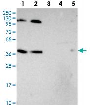 Anti-SH2D4B Rabbit Polyclonal Antibody