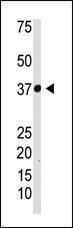 Anti-NFKBIA Rabbit Polyclonal Antibody (AP (Alkaline Phosphatase))