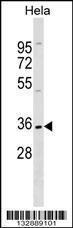 Anti-ELOVL1 Rabbit Polyclonal Antibody (Biotin)