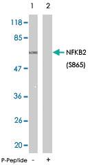 Anti-NFKB2 Rabbit Polyclonal Antibody